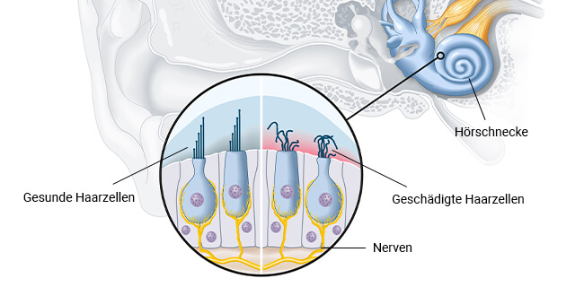 Das Corti-Organ liegt im Innenohr und beherbergt rund 15’000 Haarzellen