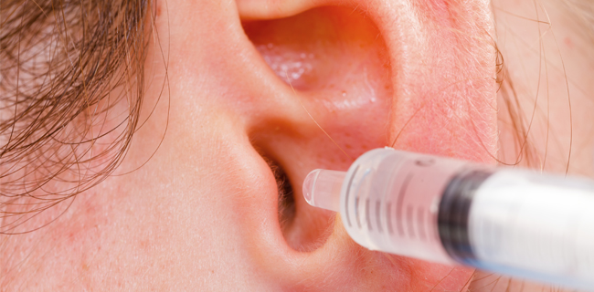 Ohrenschmalz entfernen sollten Sie niemals eigenständig mit einer umfunktionierten Spritze.