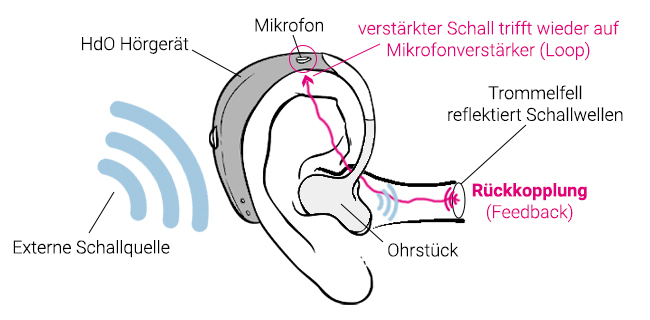Prinzip der Hörgeräterückkopplung (auch Feedback) – wenn Hörgeräte Pfeiffen.